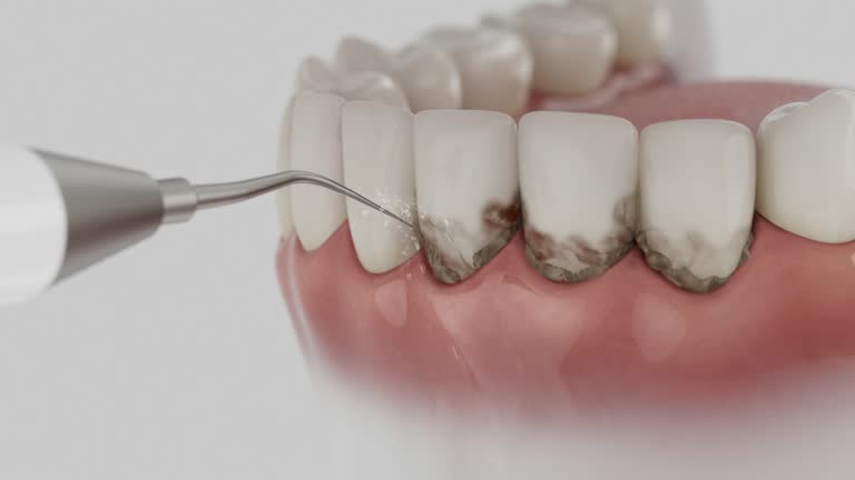 Trusted Dental Implants service in Assumption, IL - Dentist Open Now